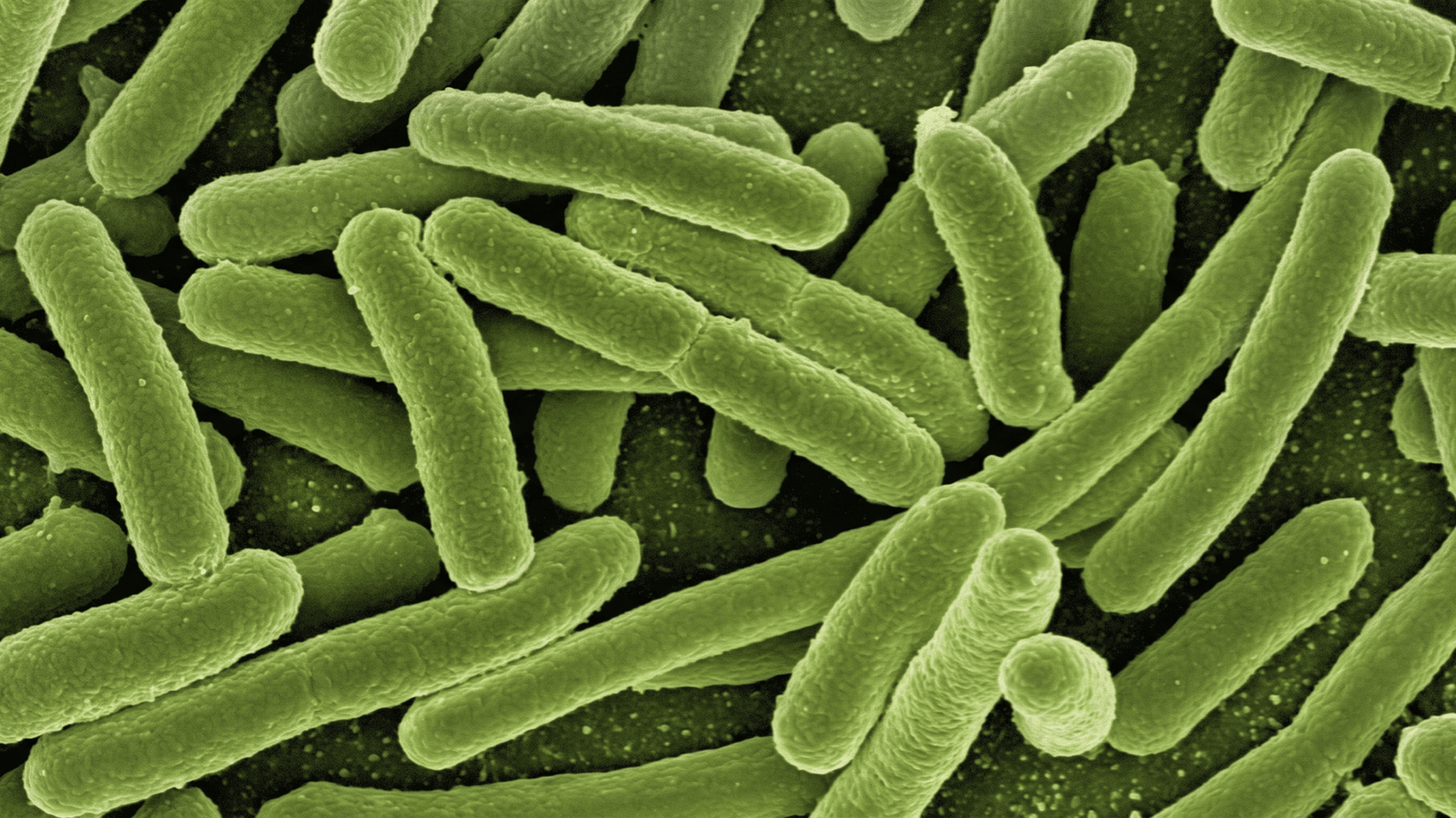 Microscopic illustration of Bifidobacterium lactis BL-04